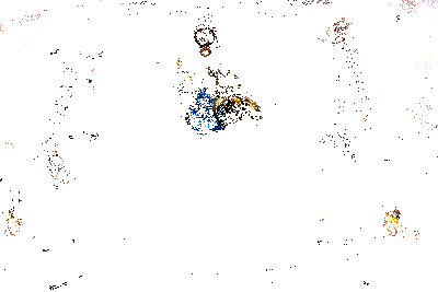 蒙多实战效果动图